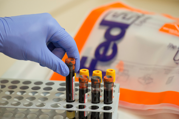 Glove-covered hand places vial in tray with FedEx packaging in background