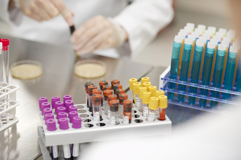 Close up: a laboratory worker fill vials with a pipette.