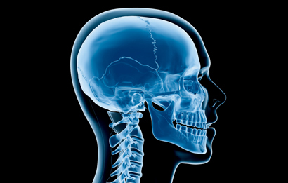 X-ray of a human skull